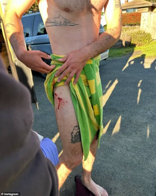 Shark Attack Sparks Debate on Coastal Safety Regulations