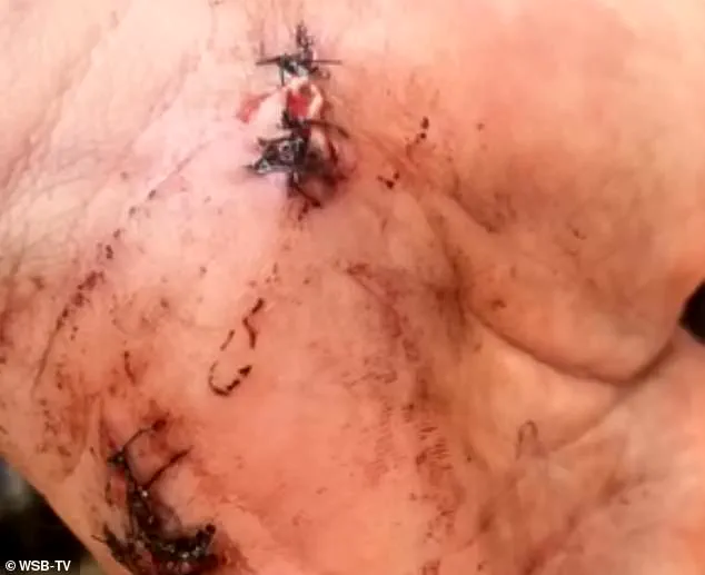 Georgia Groom Charged with Murder After Shooting Bride's Stepfather on Wedding Day; Case Sparks Debate Over Self-Defense and Justice