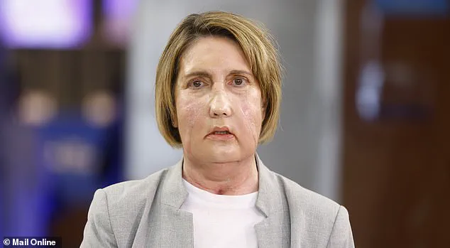 First Facial Transplant From Deceased Donor Who Chose Assisted Dying Sparks Global Debate on Ethics