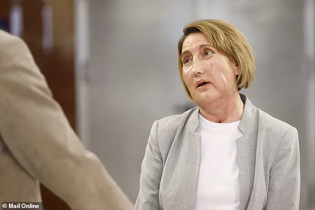 First Facial Transplant From Deceased Donor Who Chose Assisted Dying Sparks Global Debate on Ethics