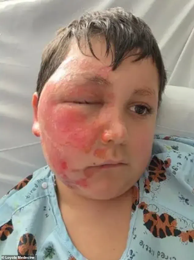Nine-Year-Old Suffers Severe Burns After Participating in Dangerous TikTok Microwave Trend Involving Sensory Toy