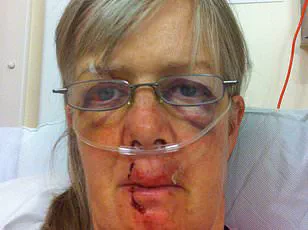 Firefighters Rescue Dog Walker Stuck in Tree After Encounter with Protective Cow on Isle of Wight