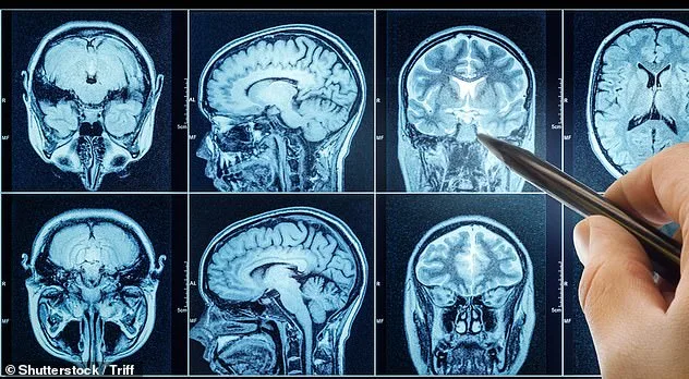 Declassified CIA Documents Reveal 60-Year-Old Cancer Breakthrough Linked to Mebendazole Patent