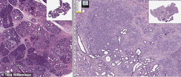 Declassified CIA Documents Reveal 60-Year-Old Cancer Breakthrough Linked to Mebendazole Patent