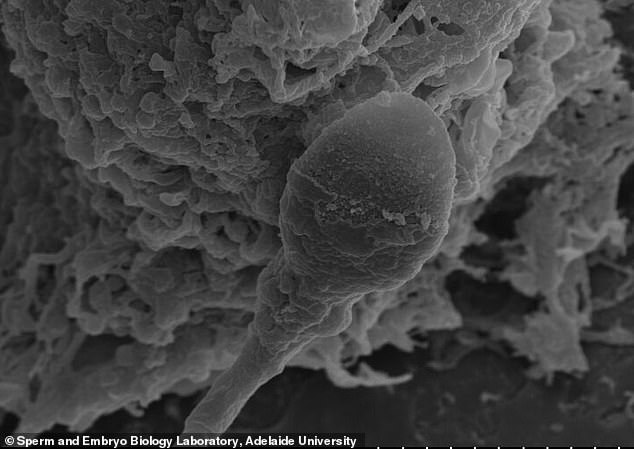 Microgravity Disrupts Sperm Movement, Study Challenges Feasibility of Conceiving in Space