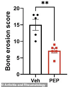 New Therapy Offers Safe, Effective Arthritis Treatment