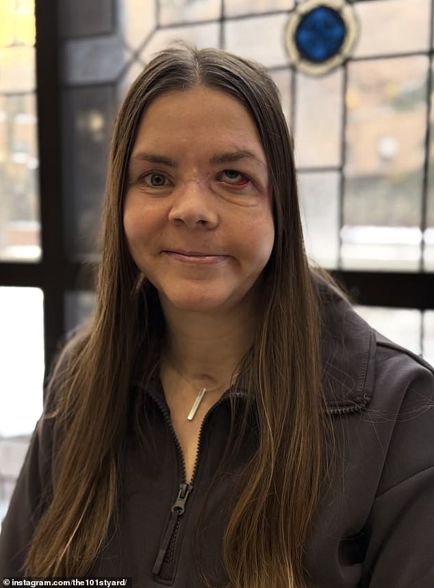 Kenai Mother Survives Bear Attack Dragging Her 100 Yards