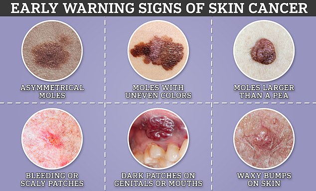 Global skin cancer cases surge toward 2050 as melanoma deaths rise.