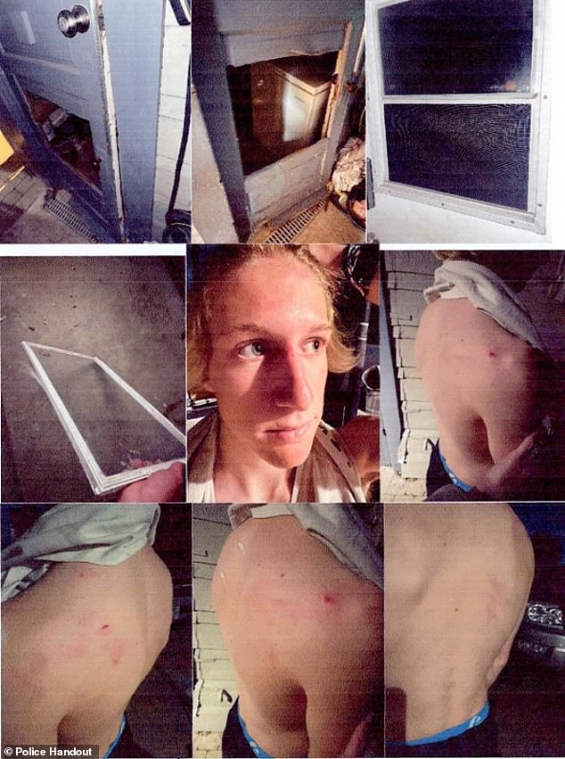 Surfer Accused of Assault Claims Ignored Victim's Rape Allegations