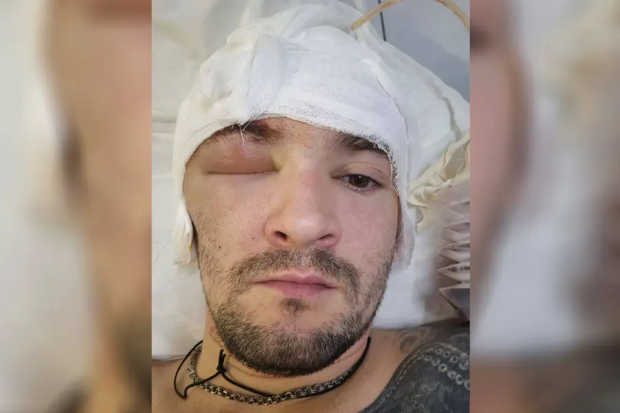 Russian Special Forces Soldier Receives Treatment for Head Wound