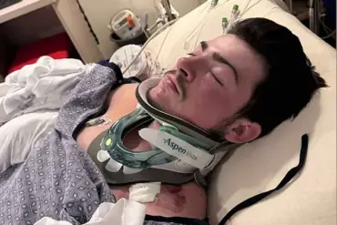 19-Year-Old's Life Changed by Hidden Danger at Hampton Beach: Medical Emergency Shakes Family