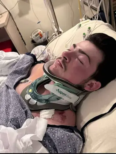 19-Year-Old's Life Changed by Hidden Danger at Hampton Beach: Medical Emergency Shakes Family