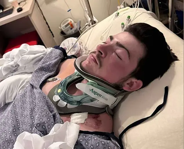 19-Year-Old's Life Changed by Hidden Danger at Hampton Beach: Medical Emergency Shakes Family