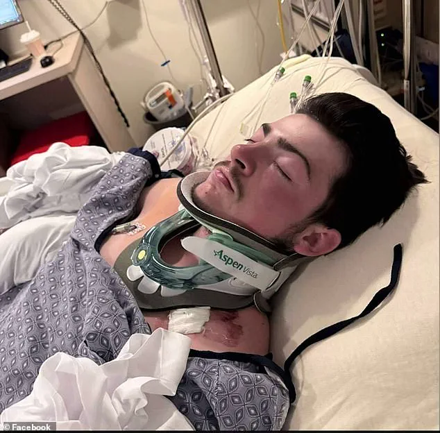19-Year-Old's Life Changed by Hidden Danger at Hampton Beach: Medical Emergency Shakes Family
