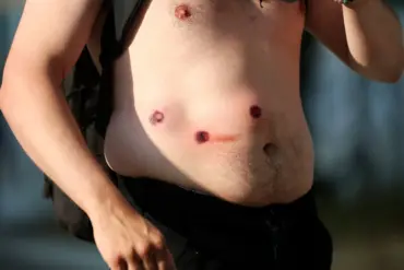 LAPD Escalates Tactics with Rubber Bullets Amid Ongoing Protests Since June 6