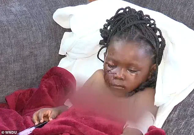 Five-Year-Old Girl in South Bend Mauled by Pit Bulls, Sustains Severe Injuries